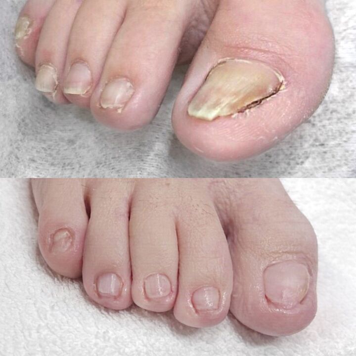 Comentarios sobre el uso de keramin.