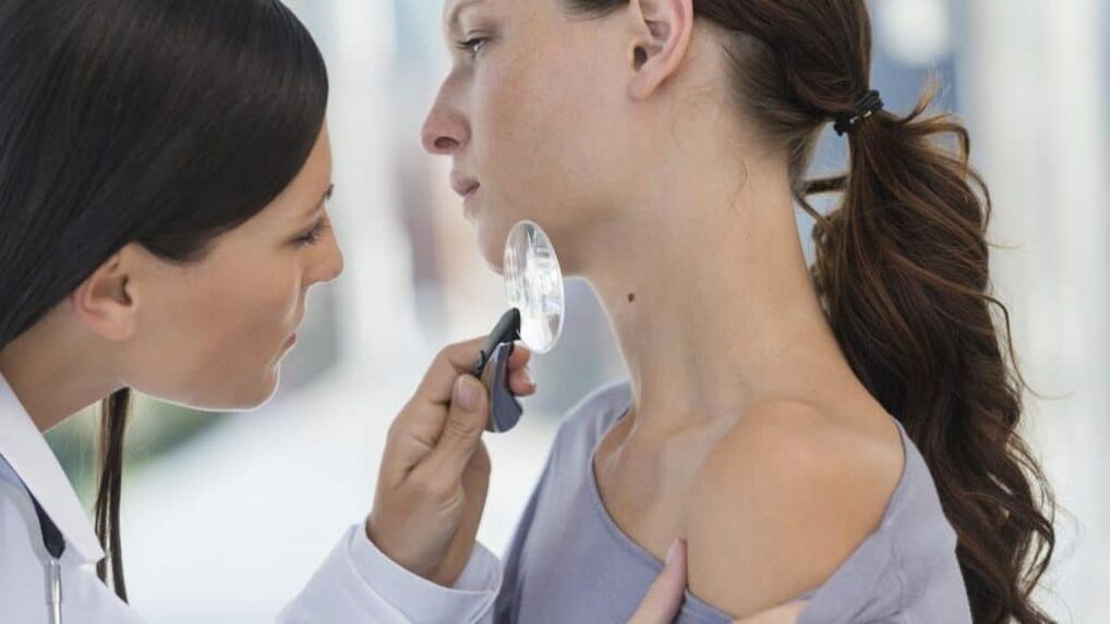 ¿Por qué aparecen papilomas en el cuello
